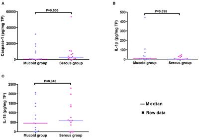 Evaluation of Caspase-1, Interleukin-1β, and Interleukin-18, in the Middle Ear Effusion in Children With Otitis Media With Effusion